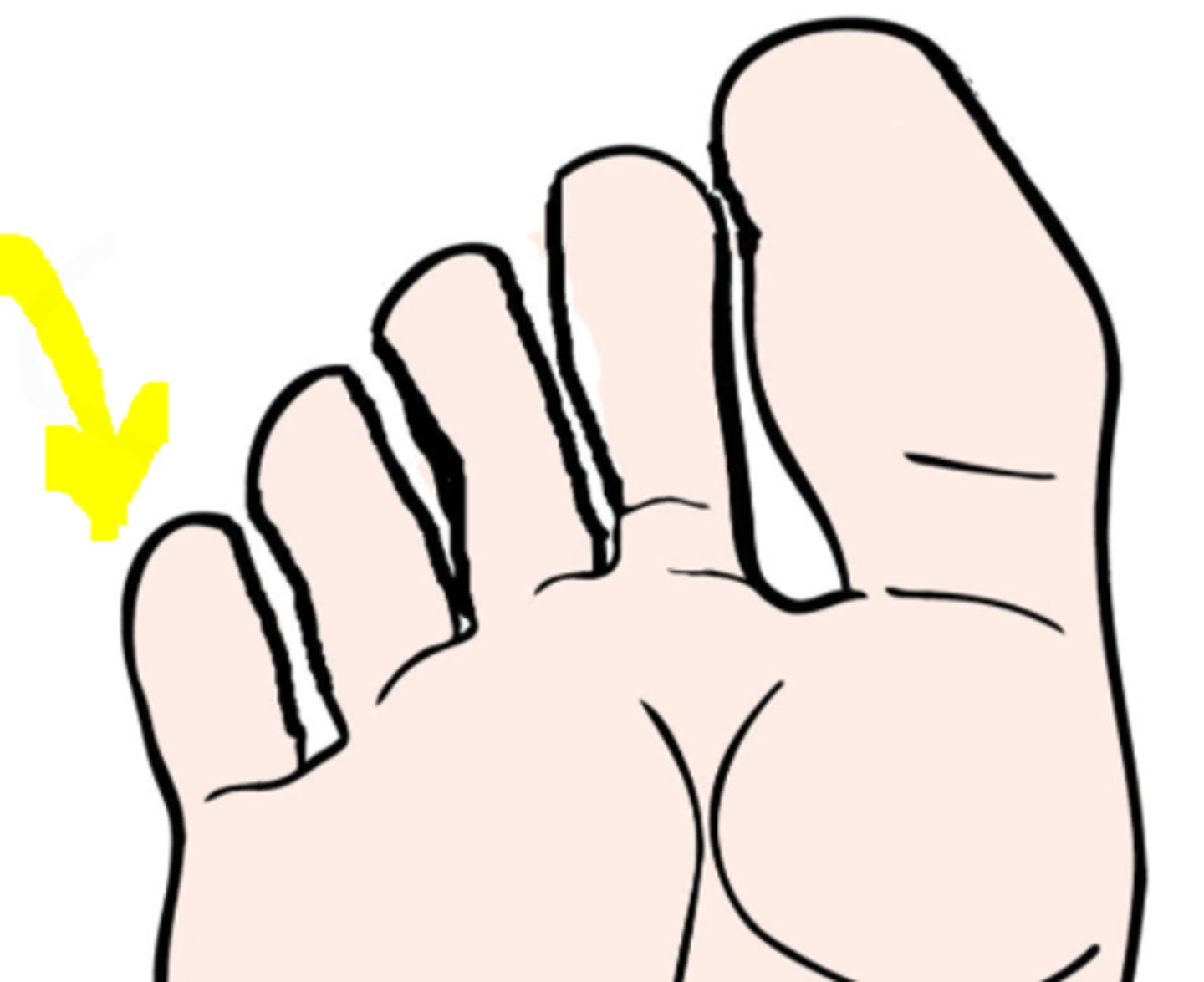 <p>little toe</p>