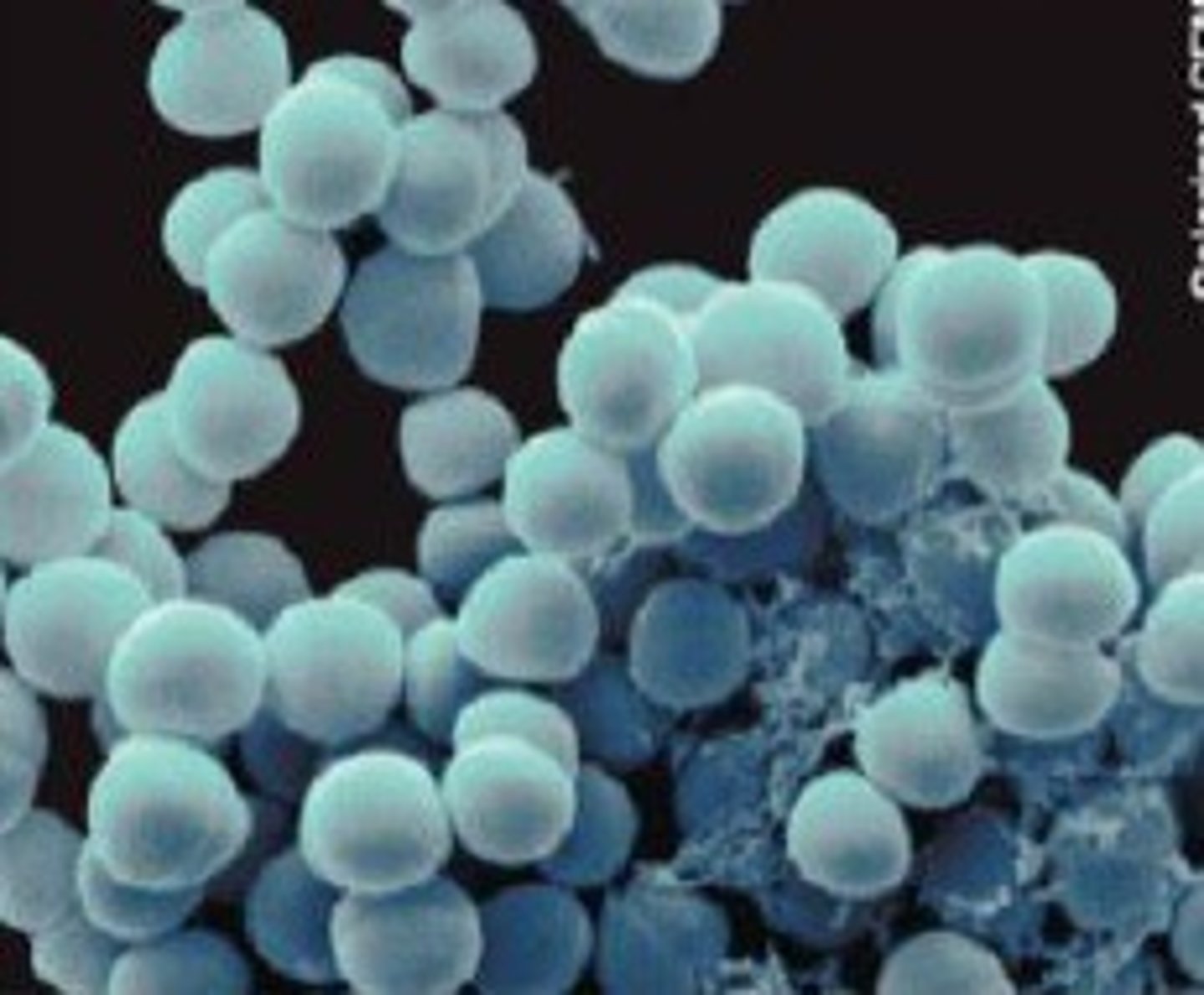 <p>sphere shaped bacteria</p>