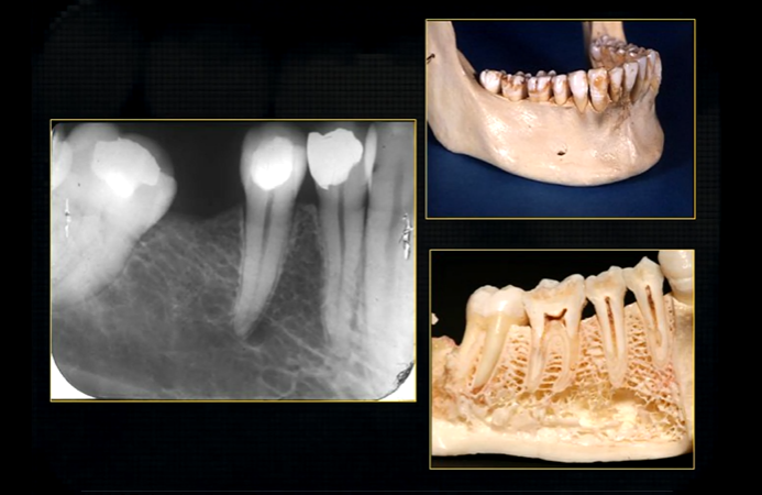 <p>periapical region </p>