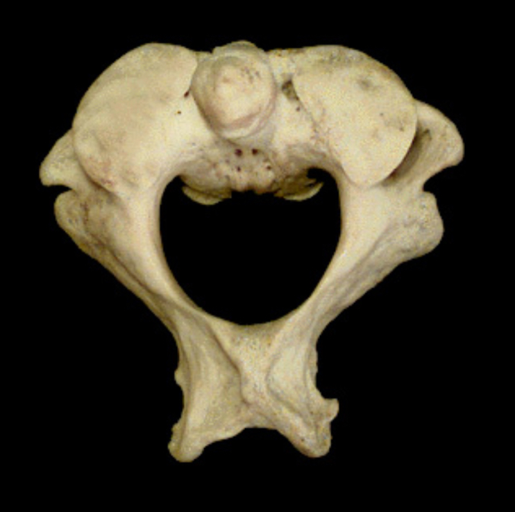 <p>What is this bone?</p>