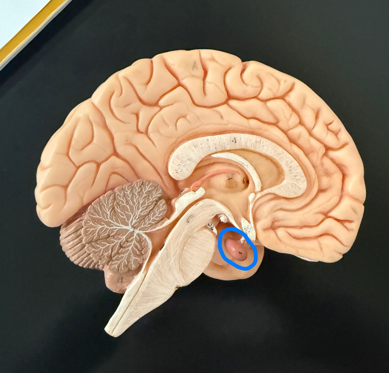 <p>What is outlined in blue on the brain model?</p>