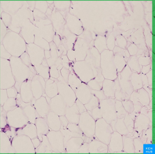 <ul><li><p>specialized connective tissue</p></li><li><p>fatty tissue found beneath the skin, around organs, and various joints, and in regions of the oral cavity</p></li><li><p>tightly packed with little or no matrix</p></li><li><p>after fibroblasts, the predominant type of cell found in this tissue is the adipocyte which stores fat intracellularly </p></li></ul><p></p>