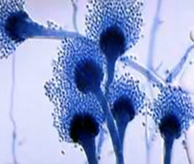 <p>What type of fungi is shown?</p>