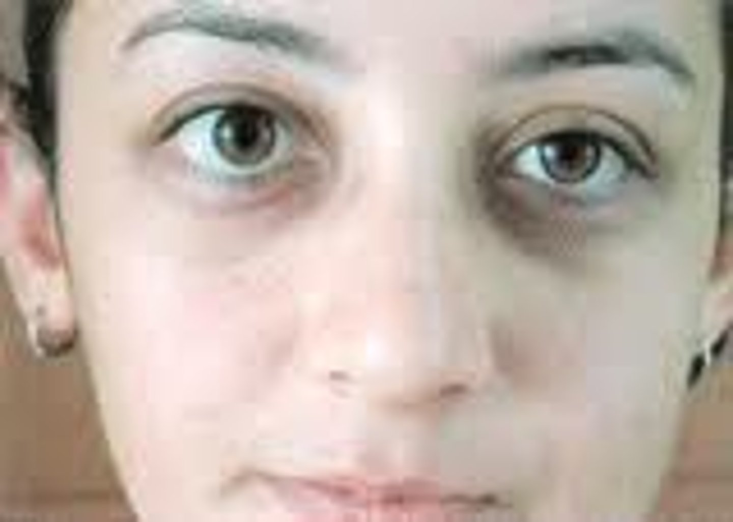 <p>Dilate</p><p>Small</p>