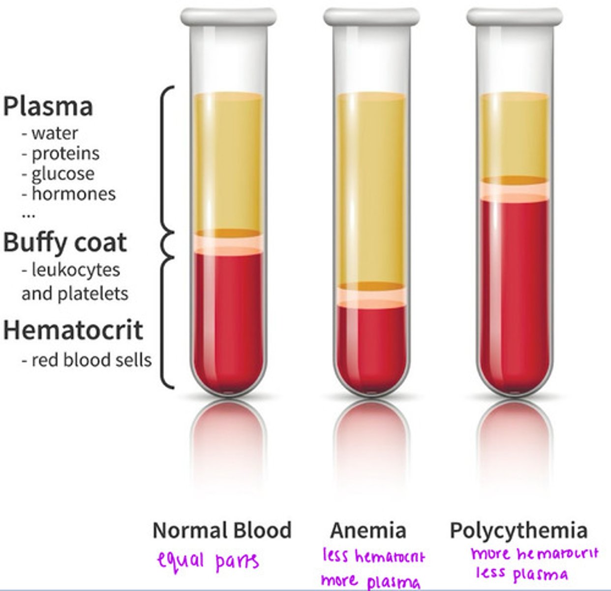 <p>normal blood: equal parts</p><p>anemia: less hematocrit, more plasma</p><p>polycythemia: more hematocrit, less plasma</p>