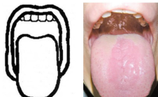 <p>Classify</p>
