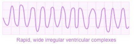 <p>What ECG trace is this?</p>