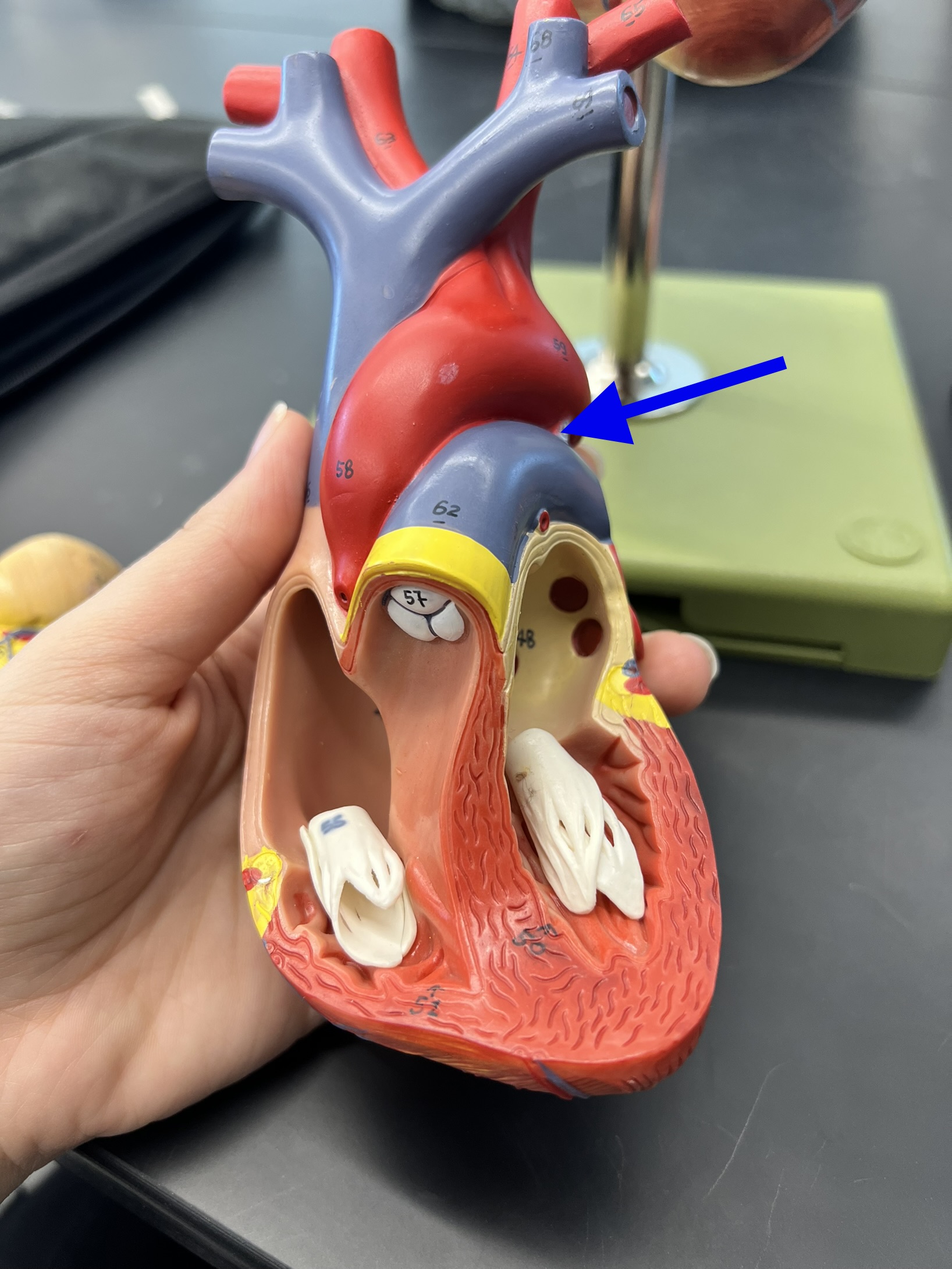 Name the heart structure.