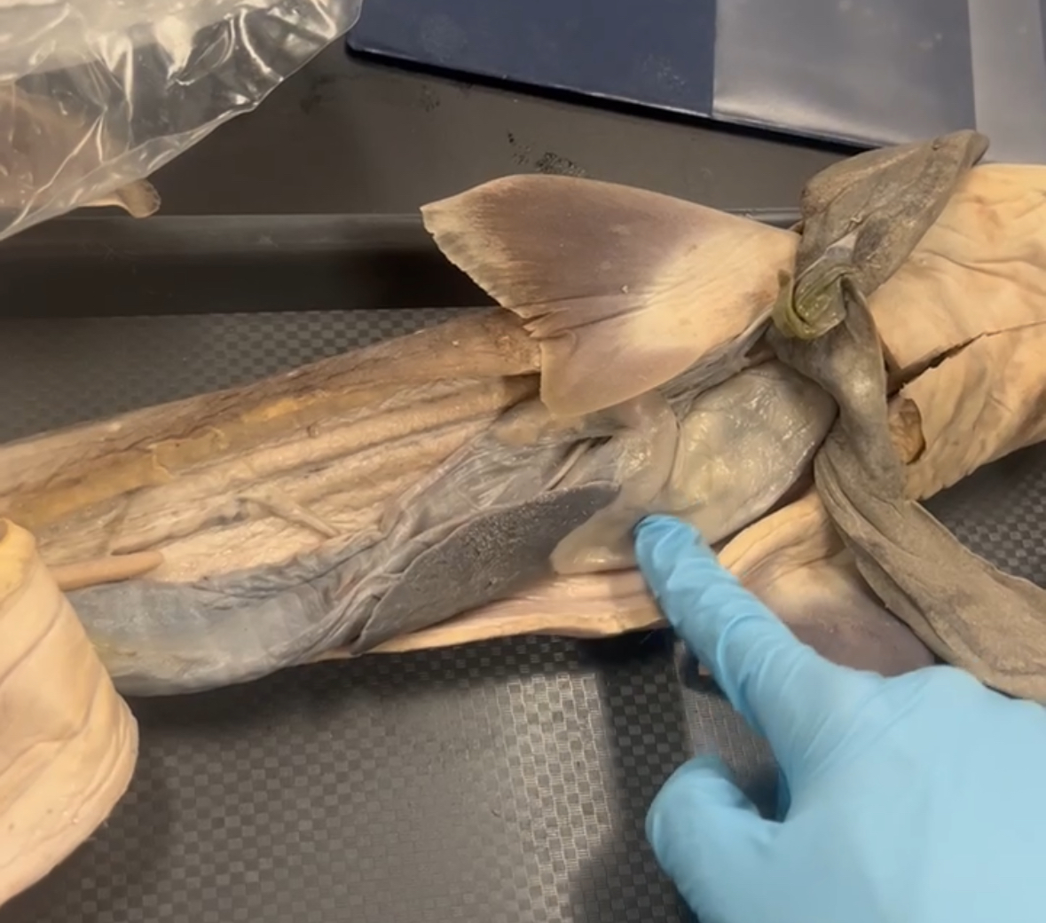 <p>Bottom of Stomach</p>