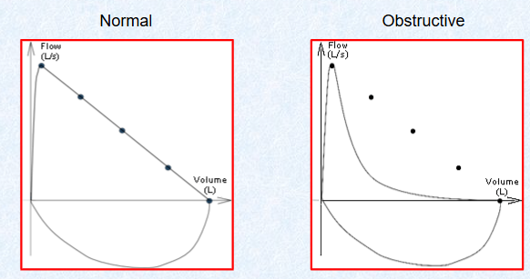 <p>flow volume loop - linear in healthy, concave in obstructive lung disease</p>