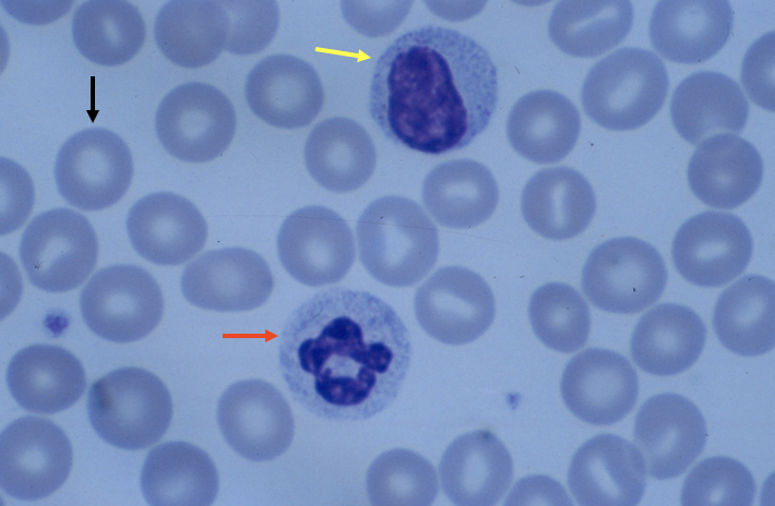 <p>What cell is the yellow arrow pointing to?</p>