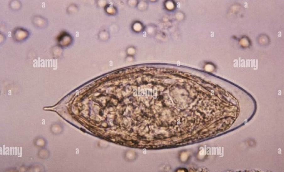 <p>A- what is the method of examination used here</p><p>B-how to use it</p><p>C- What is the name of organism</p><p></p>