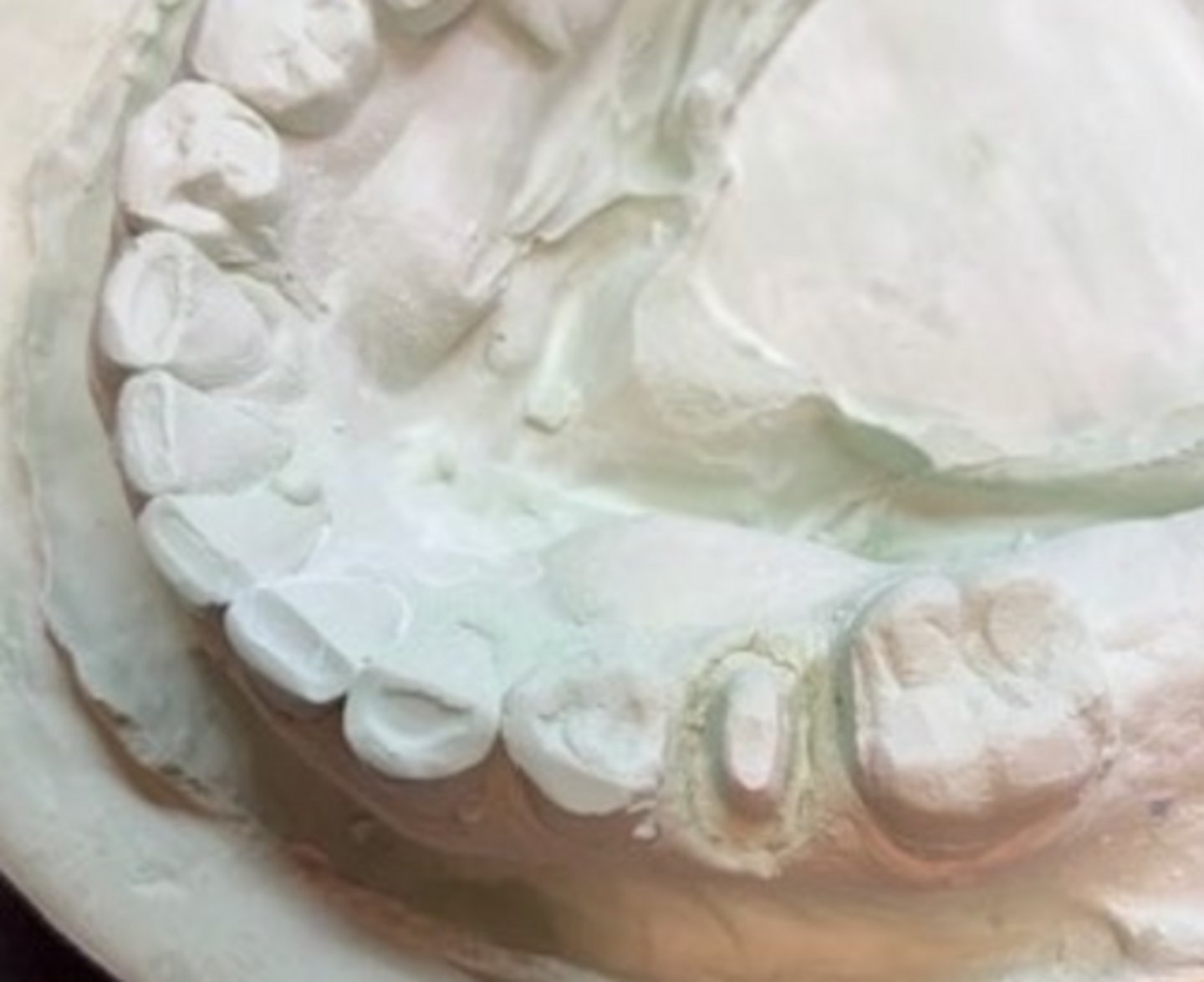 <p>Is this acceptable?</p>