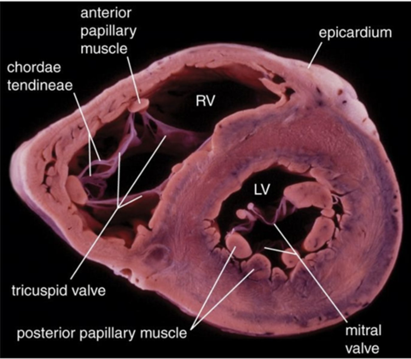 <p>What type of tissue makes up the myocardium?</p>