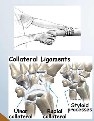 <p>Instability: radial Ligamentous Stress Test</p>