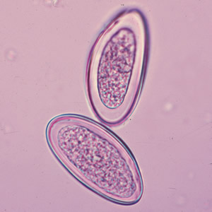 <p>Identify the 55 x 26 µm egg shown below.<br></p><p>Ancylostoma duodenale</p><p>Ascaris lumbricoides</p><p>Enterobius vermicularis</p><p>Necator americanus</p><p>Trichuris trichiura</p>