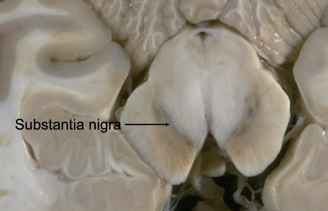 <p>What part of the <strong>midbrain</strong> influences activity of basal ganglia?</p>