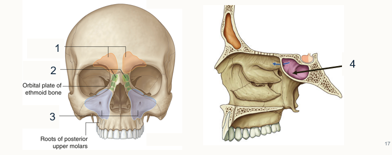 <p>Label the paranasal sinuses </p>