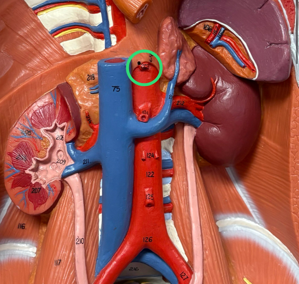 <p>large trunk off abdominal aorta that immediately splits into vessels </p>