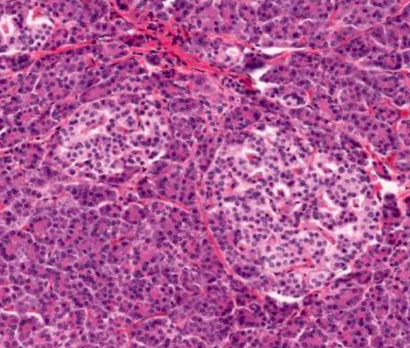 <p>Formado por los <span style="color: red"><strong>islotes de Langerhans</strong></span> que son más abundantes en la cola. También tiene cúmulos de acinos pancreáticos (exócrino)</p>
