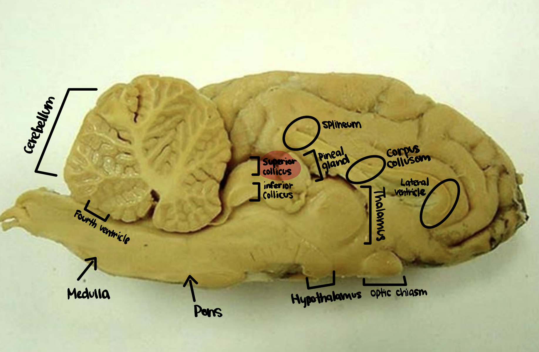 <p>Superior Colliculus</p>