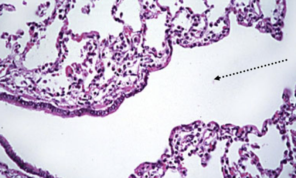 Identifying features:

•Ciliated simple cuboidal

•NO goblet cells

•No cartilage

•Less smooth muscle

•Begin to see alveolar bolus