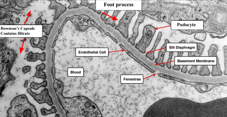 <p>filtration barrier of kidneys</p>