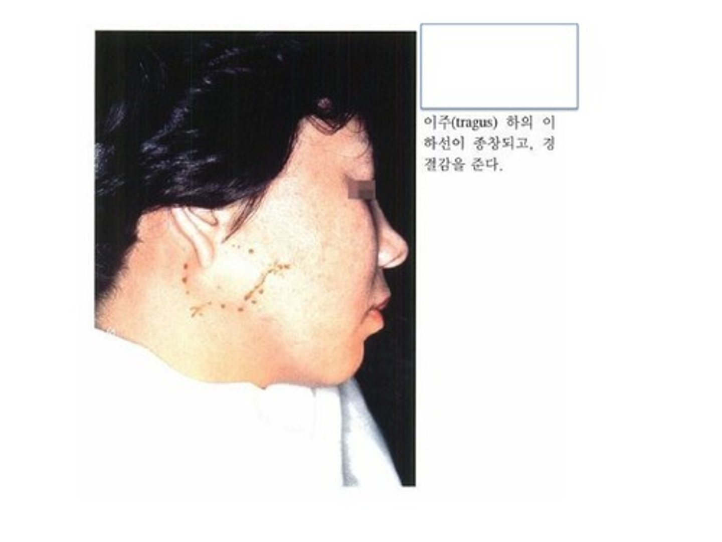 <p>because firm and they</p><p>said it was benign</p>