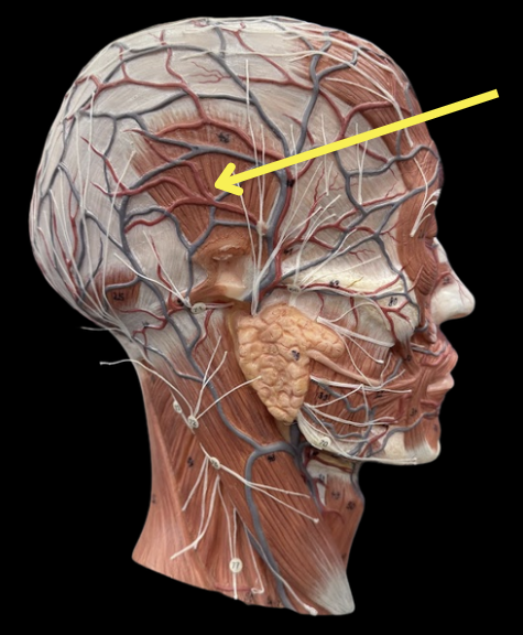 term image