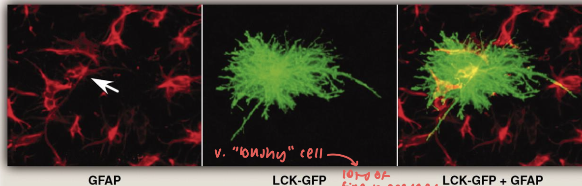 <ul><li><p>innumerable fine processes </p></li><li><p>GFAP highly expressed → doesn’t exist in processes</p></li><li><p>plasma membrane protein anchored green fluorescent (LCK-GFP) → enables visualization</p></li><li><p>astrocytes don’t overlap w e/o</p></li></ul><p></p>