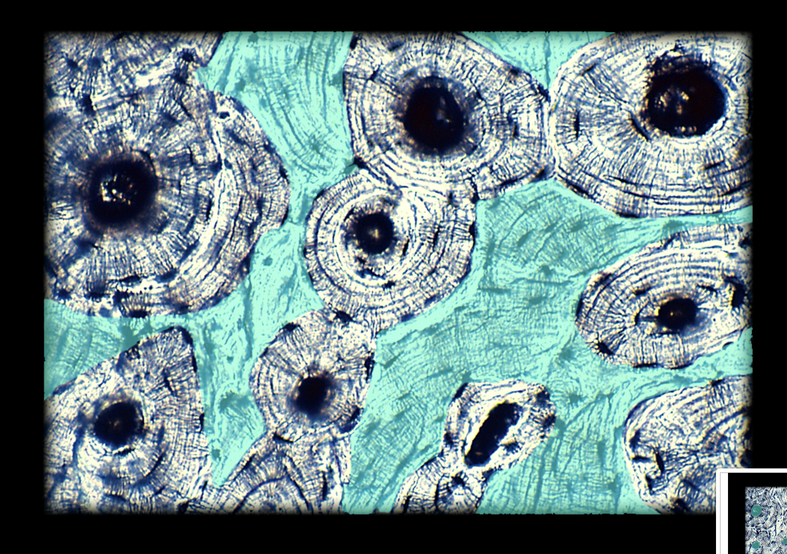 <p>Interstitial Lamella</p>