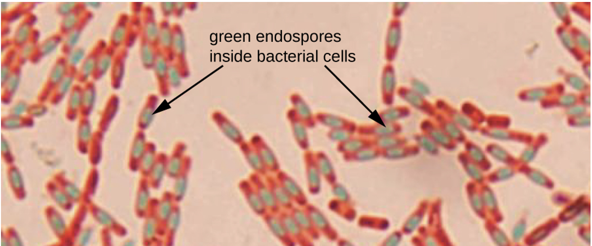 Bacillus cereus (endospore stain)