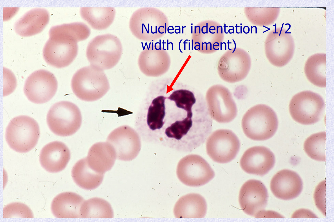 <p>What stage of Neutrophil Maturation is shown?</p>