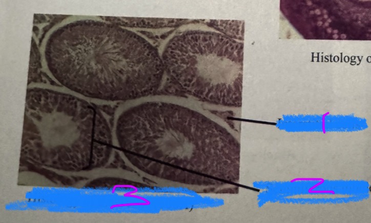 <p>What is this an image of? </p>
