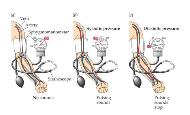 <p>order statement for how to measure blood pressure:</p><ol><li><p>The person should have been sitting down with legs uncrossed for five to ten minutes.</p></li><li><p>Inflate cuff until it exerts sufficient pressure to stop blood flow in the brachial artery.</p></li><li><p>Securely attach the cuff (not too tightly) to the upper left arm which is held supported at heart level</p></li><li><p>Use the stethoscope to listen for the sounds of blood flow and slowly release the pressure from the cuff.</p></li><li><p>When the pulsing sounds disappear the pressure is equal to that in the artery at diastole (diastolic pressure)</p></li><li><p>When pulsing sounds (Korotkoff sounds) are first heard the pressure is equal to that in the artery at systole (systolic pressure)</p></li></ol>