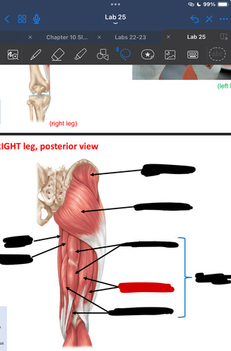 <p>What muscle is this?</p>
