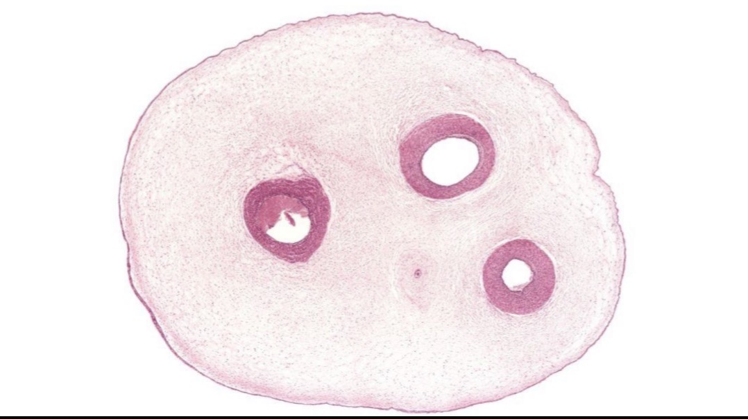 <p>Tejido embrionario mucoso cord贸n umbilical </p>