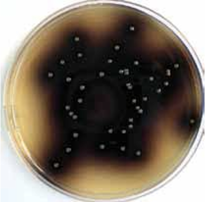 <p>Selective &amp; Differential </p><p>Selects for certain G+, against all G- </p><p>— selecting agent: sodium azide inhibitory for G-                               bile inhibitory to some G+ </p><p>— differential agent: esculin and ferric citrate </p><p>Turns a dark brown/black pigment </p>