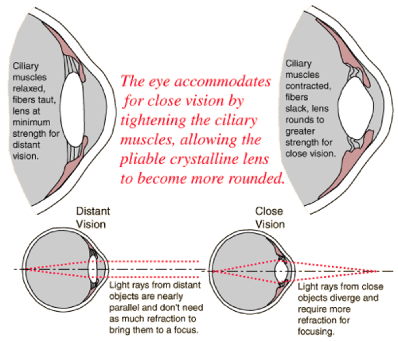 <p>paralysis of the ciliary muscle (lens cannot accommodate)</p><p>- side effect of muscarinic antagonists</p>