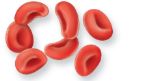 <p>What are the biconcave disc shaped cells?</p>