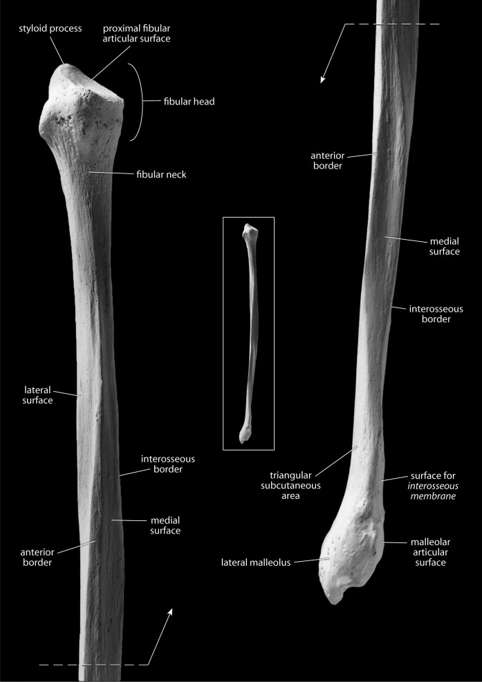 <p>round, flat, anterior and medial</p>