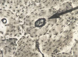 <p>what kind of tissue is this and where is the arrow pointing to</p>