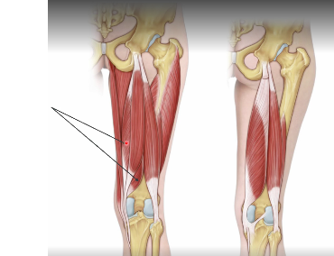 <p>semimembranosus O,I, A</p>