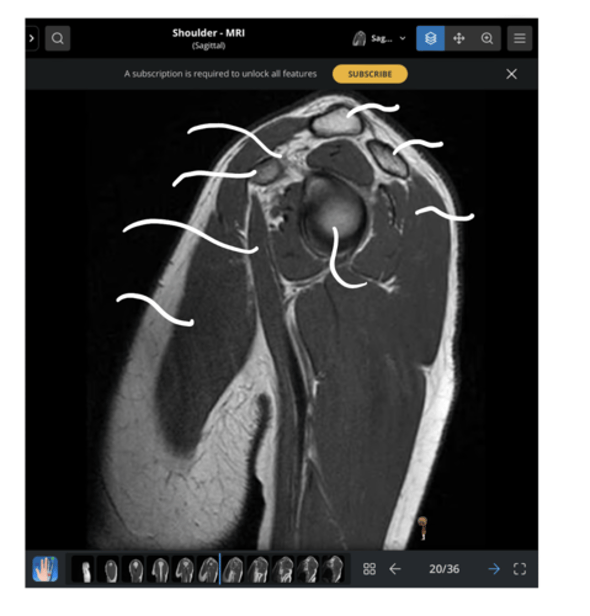 <p>Working our way clockwise, which structures are being pointed to in this image?</p>