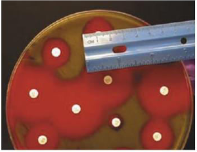 <p>What is used to standardized the approximate number of bacteria in this test?</p>