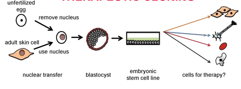 <p>experimental cloning. Use to make patient specific cell lines isolated from an embryo (not intended for transfer in utero)</p><p>transfer of nuclear material from a somatic cell into an enucleated oocyte with the goal of deriving embryonic stem cell lines with the same genome as the nuclear donor</p><p>little to no risk of rejecting transplanted cells/tissues - immunology compatible with patient</p><p>ethical concerns and technical challenges</p>
