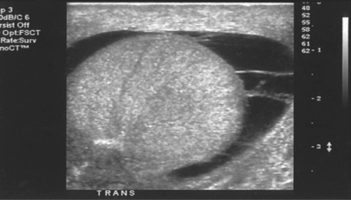 What is the transducer display in this image?
