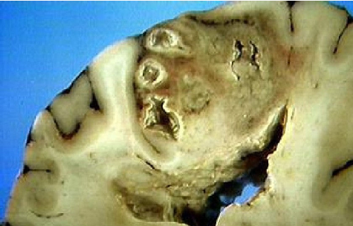 <p></p>