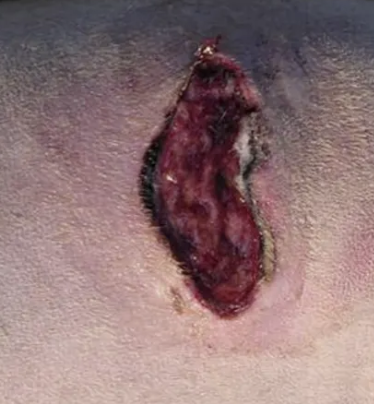 <p><strong><u><mark data-color="purple" style="background-color: purple; color: inherit;">EXAMPLE:</mark></u></strong><mark data-color="purple" style="background-color: purple; color: inherit;"> Dog flank laceration after running into a car door. Wound is only a couple hours old. There is no pus, but hair and dirt is present on the surface of the SC fat and muscle</mark></p><ol><li><p><mark data-color="purple" style="background-color: purple; color: inherit;">Classify the wound</mark></p></li><li><p><mark data-color="purple" style="background-color: purple; color: inherit;">How do you proceed?</mark></p></li><li><p><mark data-color="purple" style="background-color: purple; color: inherit;">Clinical reasoning</mark></p></li></ol><p></p>