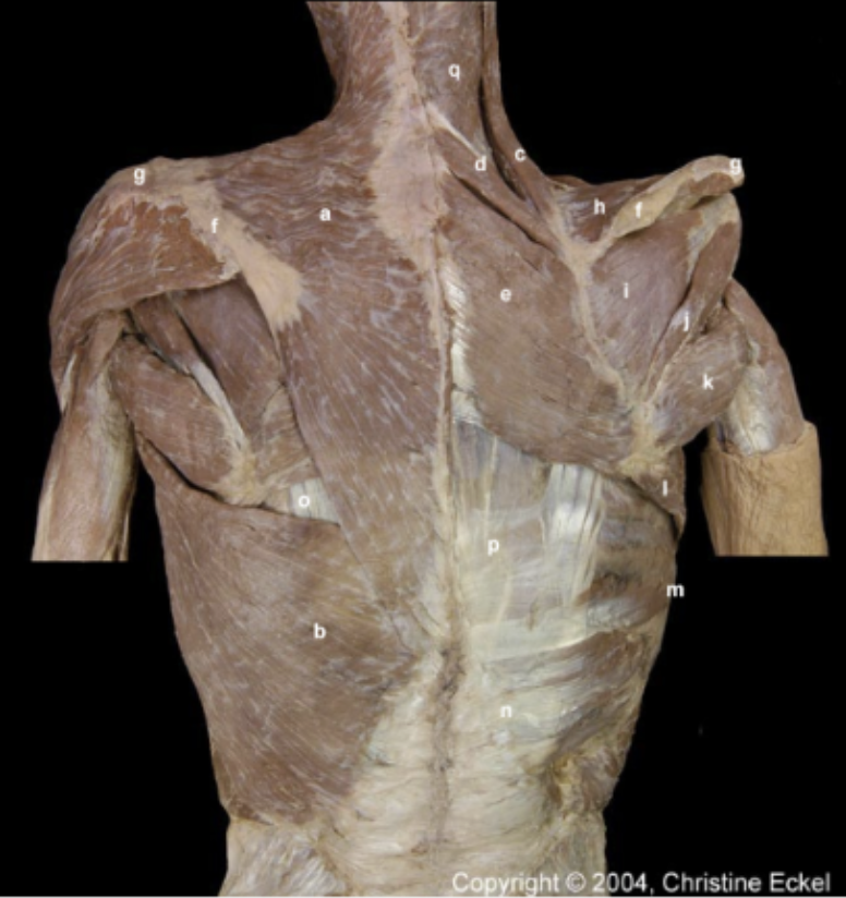 <p>Extrinsic Muscles of the Back</p>